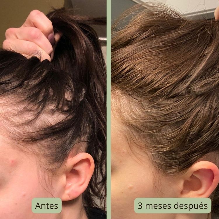 Zahara Elixir - Gotas Energéticas para el Cabello