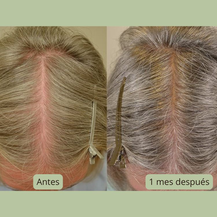 Zahara Elixir - Gotas Energéticas para el Cabello