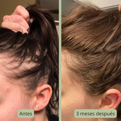 Zahara Elixir - Gotas Energéticas para el Cabello