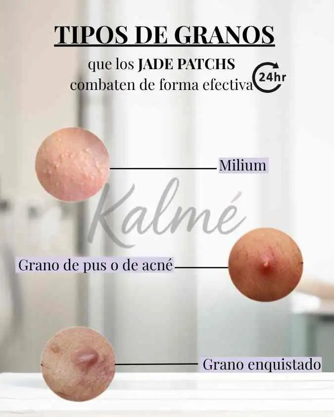 Jade Patch - Elimina todo tipo de espinillas y granos en menos de 24 horas (1+1 GRÁTIS)