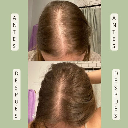 Zahara Elixir - Gotas Energéticas para el Cabello